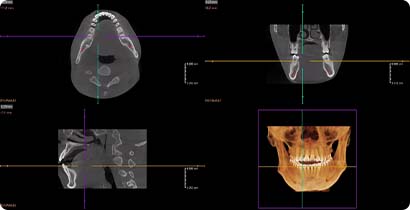 3D CT Images