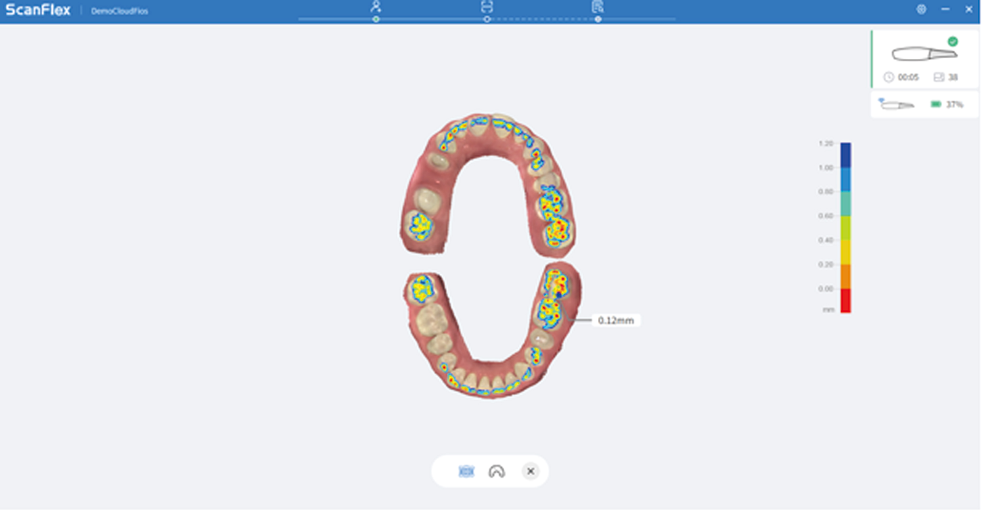 Occlusion Analysis