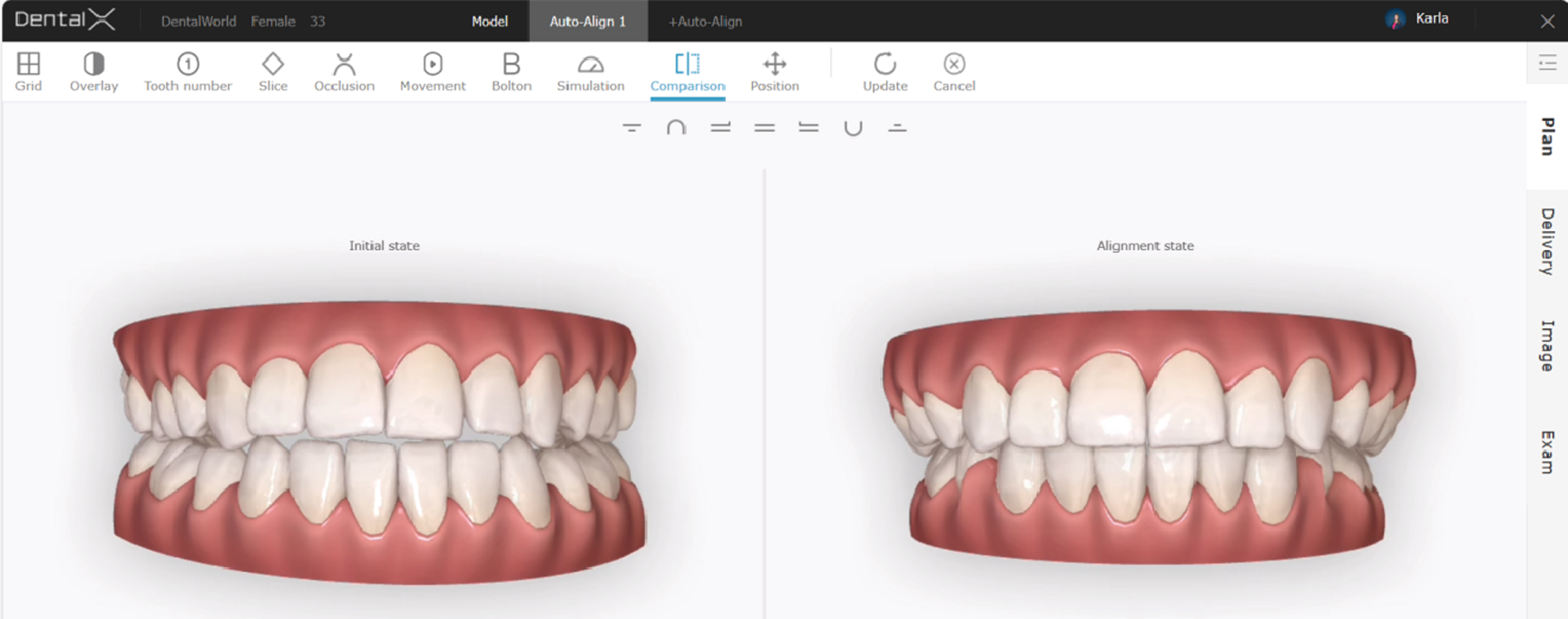 Orthodontic Simulator