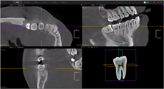 Show Individual Teeth