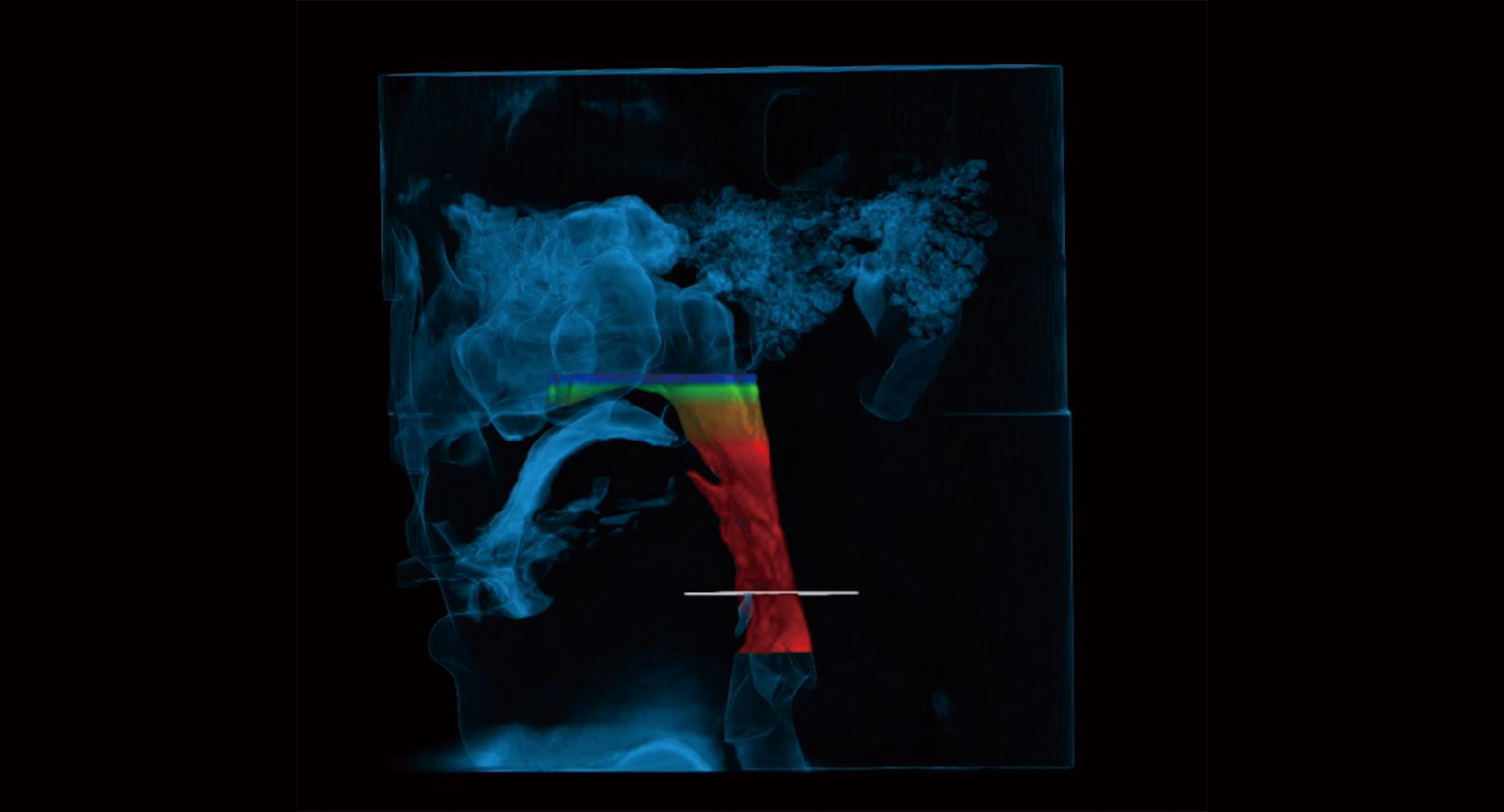 Airway Analysis