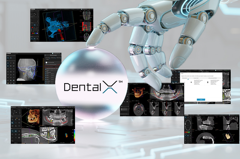 Artificial Intelligence in Dental Imaging – A New Era of Precision and Efficiency